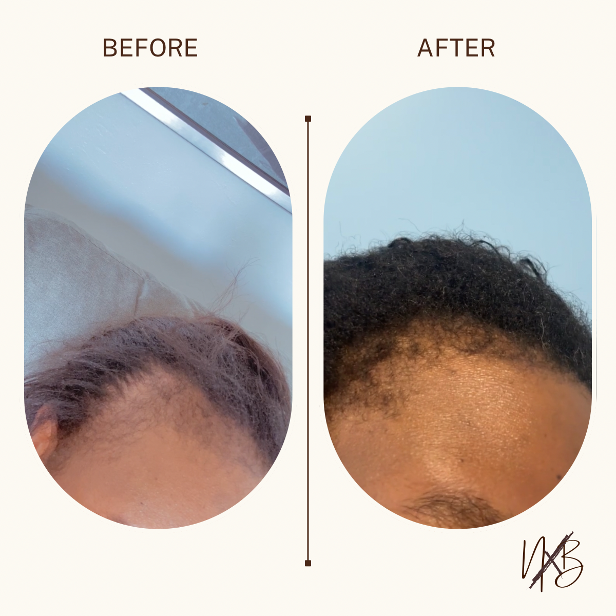 Ayurvedic Herbal Hair Growth Oil