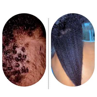 Ayurvedic Herbal Hair Growth Oil