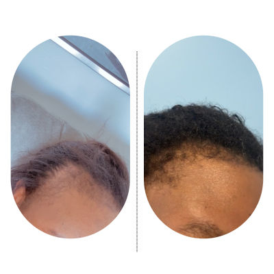 Ayurvedic Herbal Hair Growth Oil