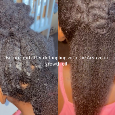 Ayurvedic Herbal Hair Growth Oil