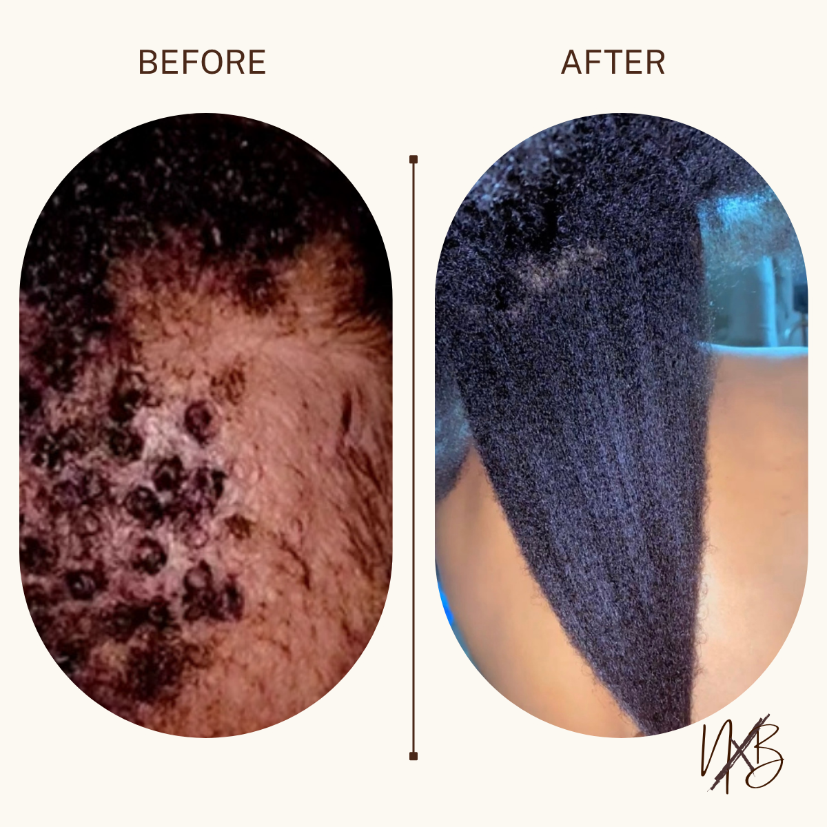 Ayurvedic Herbal Hair Growth Oil