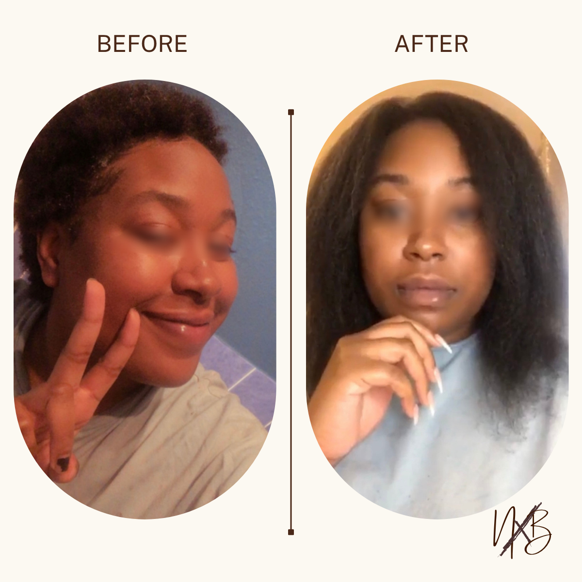 Ayurvedic Herbal Hair Growth Oil
