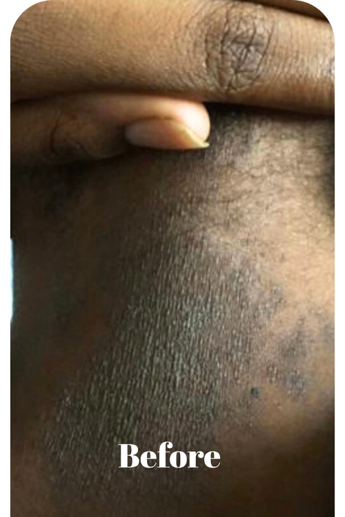 Before & After