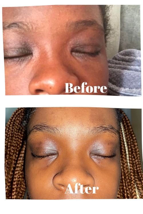 Before & After