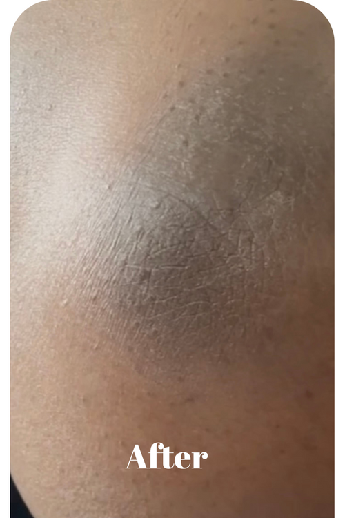 Before & After